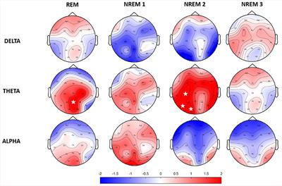 All-night spectral and microstate EEG analysis in patients with recurrent isolated sleep paralysis